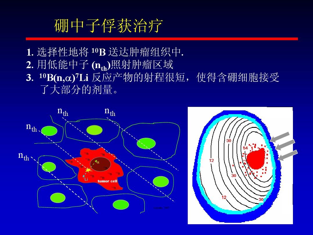 复发性胶质母细胞瘤（GB)的治疗新选择-基于加速器的硼中子俘获技术（BNCT）